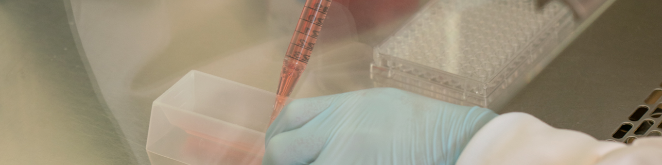 Enabling Exosome Therapy